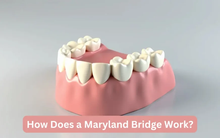 How Does a Maryland Bridge Work? Understanding the Procedure