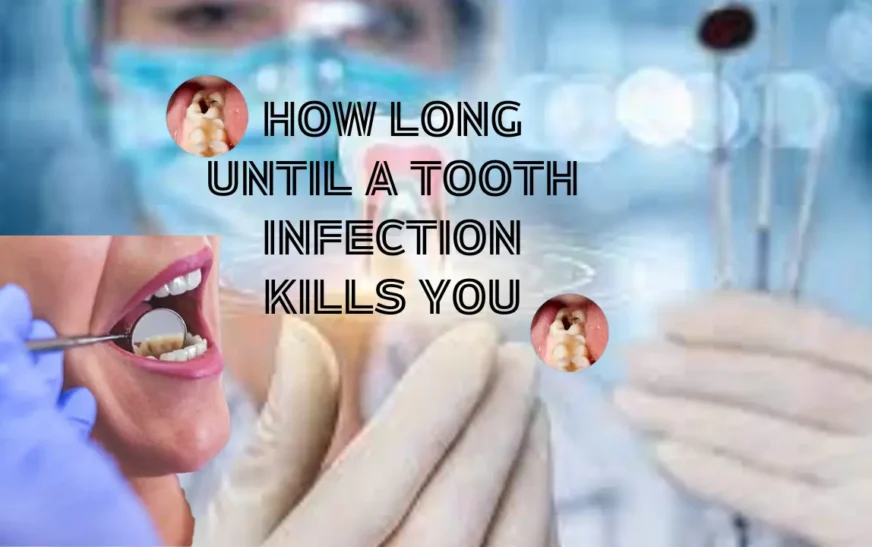 how long until a tooth infection kills you