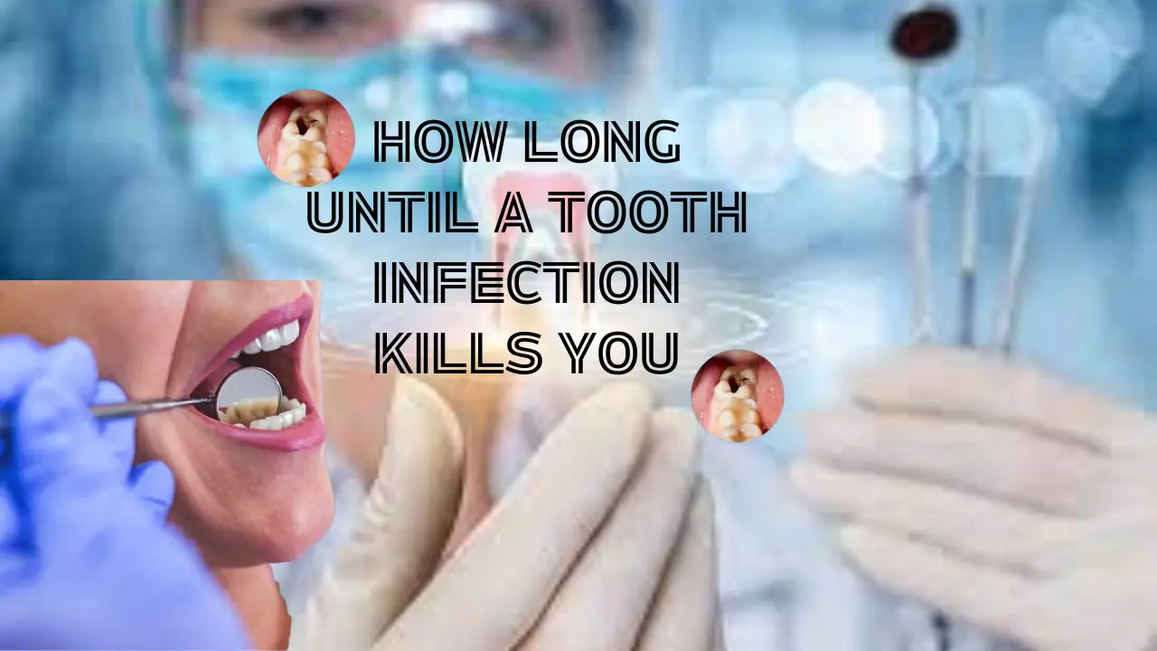 How long until a tooth infection kills you