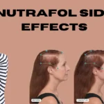 nutrafol side effects