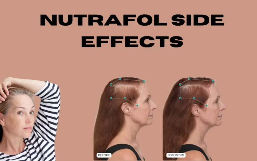 Nutrafol side effects